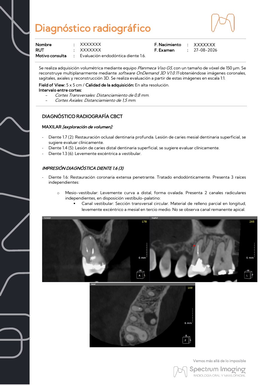 Primera página de un informe CBCT para evaluación endodóntica